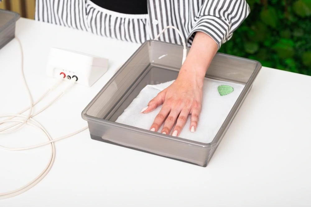 Treating excessive sweating hands with Hidroxa iontophoresis machine